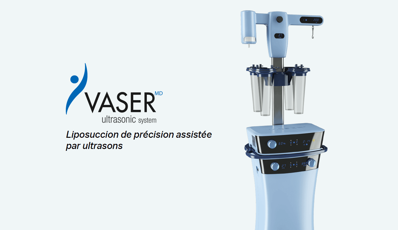 VASERlipo